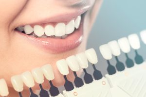 Tips and Best Practices to Maintain Your Cosmetic Dentistry Results