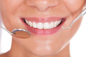 Tackling a Gummy Smile: Solutions for a More Balanced Look